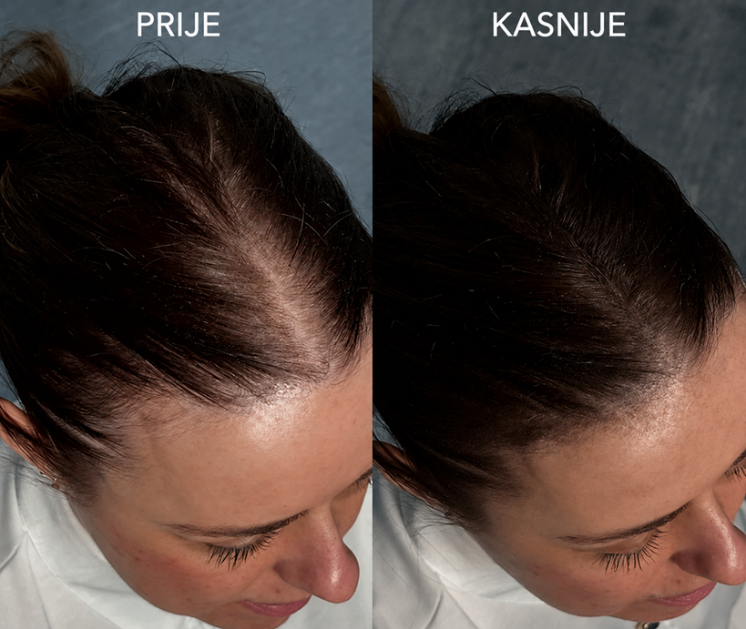 NANOGEN keratinska vlakna 15g / 30g - Slika 7