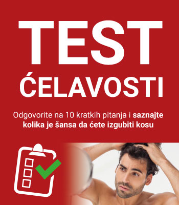 banner_test_celavosti_sidebar